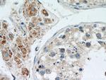 MRPL10 Antibody in Immunohistochemistry (Paraffin) (IHC (P))