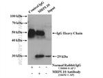 MRPL10 Antibody in Immunoprecipitation (IP)