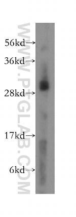 MRPL10 Antibody in Western Blot (WB)