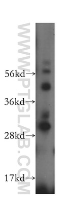 MRPL10 Antibody in Western Blot (WB)