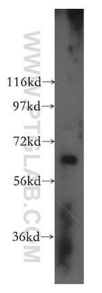 DDX52 Antibody in Western Blot (WB)