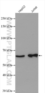 DDX52 Antibody in Western Blot (WB)