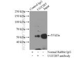 UGT2B7 Antibody in Immunoprecipitation (IP)