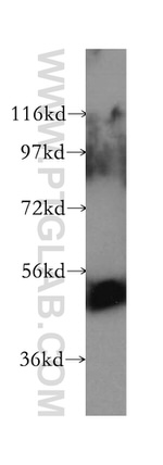 UGT2B7 Antibody in Western Blot (WB)