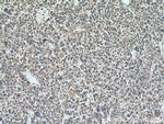 PPA2 Antibody in Immunohistochemistry (Paraffin) (IHC (P))