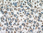 PPA2 Antibody in Immunohistochemistry (Paraffin) (IHC (P))