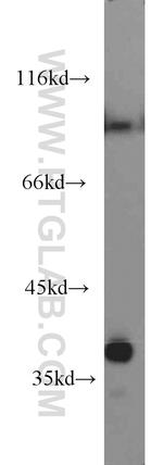 PPA2 Antibody in Western Blot (WB)