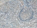 CD40L/CD154 Antibody in Immunohistochemistry (Paraffin) (IHC (P))