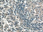 CD40L/CD154 Antibody in Immunohistochemistry (Paraffin) (IHC (P))