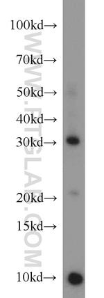 CD40L/CD154 Antibody in Western Blot (WB)