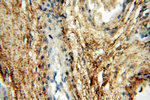 HPSE Antibody in Immunohistochemistry (Paraffin) (IHC (P))