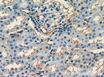 HPSE Antibody in Immunohistochemistry (Paraffin) (IHC (P))