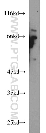 HPSE Antibody in Western Blot (WB)