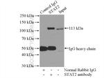 STAT2 Antibody in Immunoprecipitation (IP)