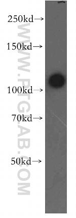 STAT2 Antibody in Western Blot (WB)