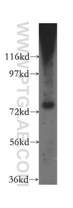 AMFR Antibody in Western Blot (WB)