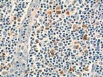 CD244 Antibody in Immunohistochemistry (Paraffin) (IHC (P))