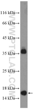 POLR1D Antibody in Western Blot (WB)