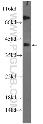 DCTPP1 Antibody in Western Blot (WB)