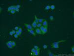 DCTPP1 Antibody in Immunocytochemistry (ICC/IF)