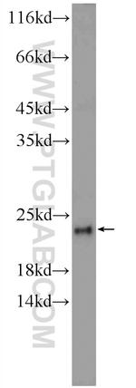 DCTPP1 Antibody in Western Blot (WB)