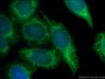 CRK Antibody in Immunocytochemistry (ICC/IF)