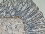 PARP11 Antibody in Immunohistochemistry (Paraffin) (IHC (P))