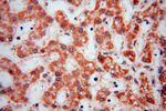 PARP11 Antibody in Immunohistochemistry (Paraffin) (IHC (P))