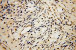 PARP11 Antibody in Immunohistochemistry (Paraffin) (IHC (P))