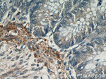 PARP11 Antibody in Immunohistochemistry (Paraffin) (IHC (P))