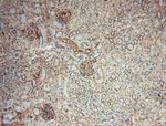 PARP11 Antibody in Immunohistochemistry (Paraffin) (IHC (P))