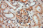 PARP11 Antibody in Immunohistochemistry (Paraffin) (IHC (P))