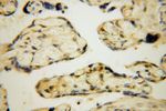 PARP11 Antibody in Immunohistochemistry (Paraffin) (IHC (P))