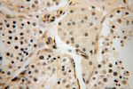 PARP11 Antibody in Immunohistochemistry (Paraffin) (IHC (P))