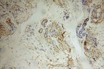 PARP11 Antibody in Immunohistochemistry (Paraffin) (IHC (P))