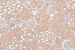 PARP11 Antibody in Immunohistochemistry (Paraffin) (IHC (P))