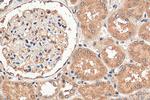 PARP11 Antibody in Immunohistochemistry (Paraffin) (IHC (P))