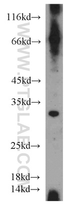 PARP11 Antibody in Western Blot (WB)