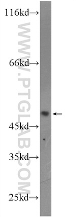 MTRF1L Antibody in Western Blot (WB)