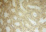 ARHGAP4 Antibody in Immunohistochemistry (Paraffin) (IHC (P))