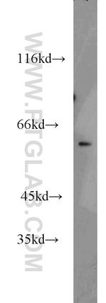 NKD2 Antibody in Western Blot (WB)