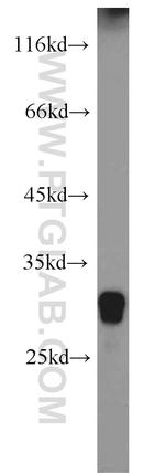 IDI2 Antibody in Western Blot (WB)