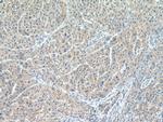 CYP20A1 Antibody in Immunohistochemistry (Paraffin) (IHC (P))