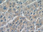 CYP20A1 Antibody in Immunohistochemistry (Paraffin) (IHC (P))