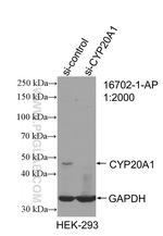 CYP20A1 Antibody in Western Blot (WB)