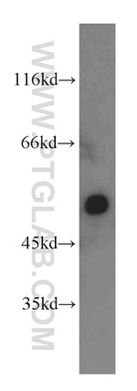 CYP20A1 Antibody in Western Blot (WB)