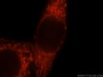 GSTA3 Antibody in Immunocytochemistry (ICC/IF)