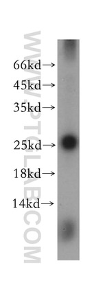 GSTA3 Antibody in Western Blot (WB)