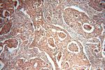 MTH1 Antibody in Immunohistochemistry (Paraffin) (IHC (P))