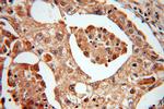 MTH1 Antibody in Immunohistochemistry (Paraffin) (IHC (P))